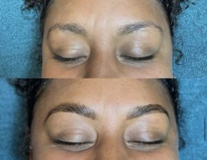 A woman with her eyes closed and then she has just had the brows done.